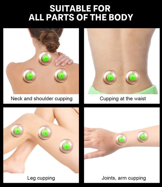 6-teiliges Vakuum-Schröpfset für effektive Körpermassage