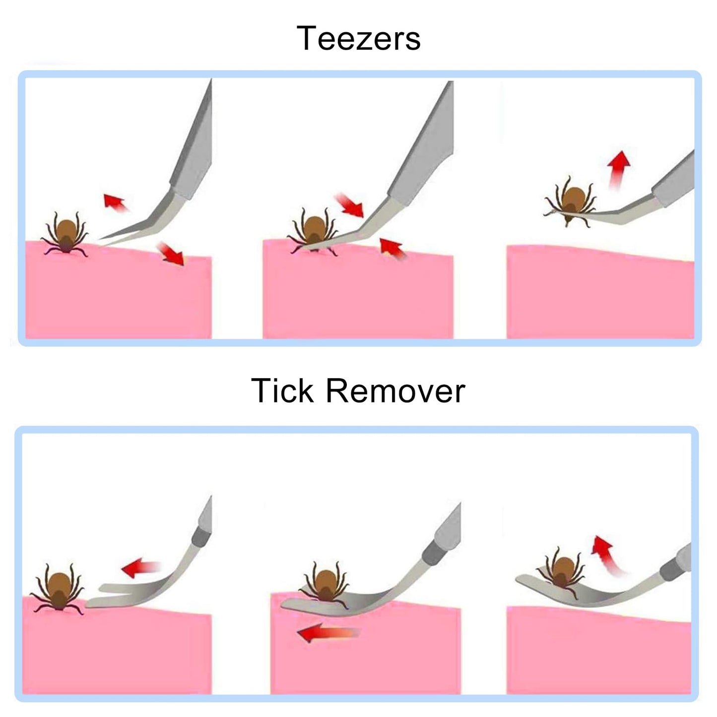 Profi Edelstahl Zeckenzange 2 in 1 sicher und zuverlässig für Hund und Katze-Nutabevr
