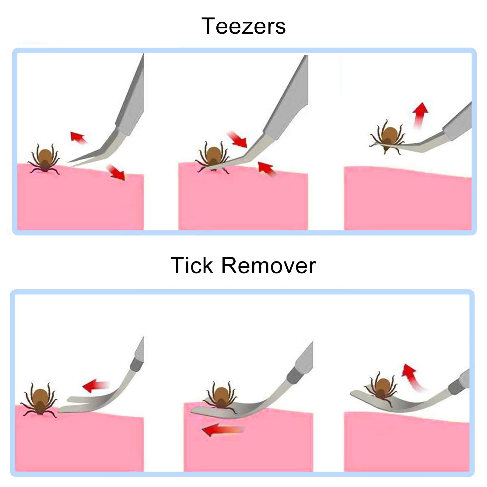 Profi Edelstahl Zeckenzange 2 in 1 sicher und zuverlässig für Hund und Katze-Nutabevr