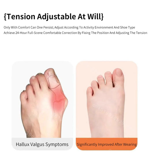 Vorgeschnittenes Ballenzehen Korrekturband für Hallux Valgus Schmerzlinderung