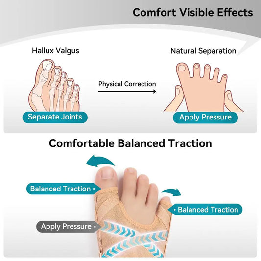 Bunion Corrector Atmungsaktive Zehenkorrektur Hallux Valgus Sleeve-Yabubest - Home & More