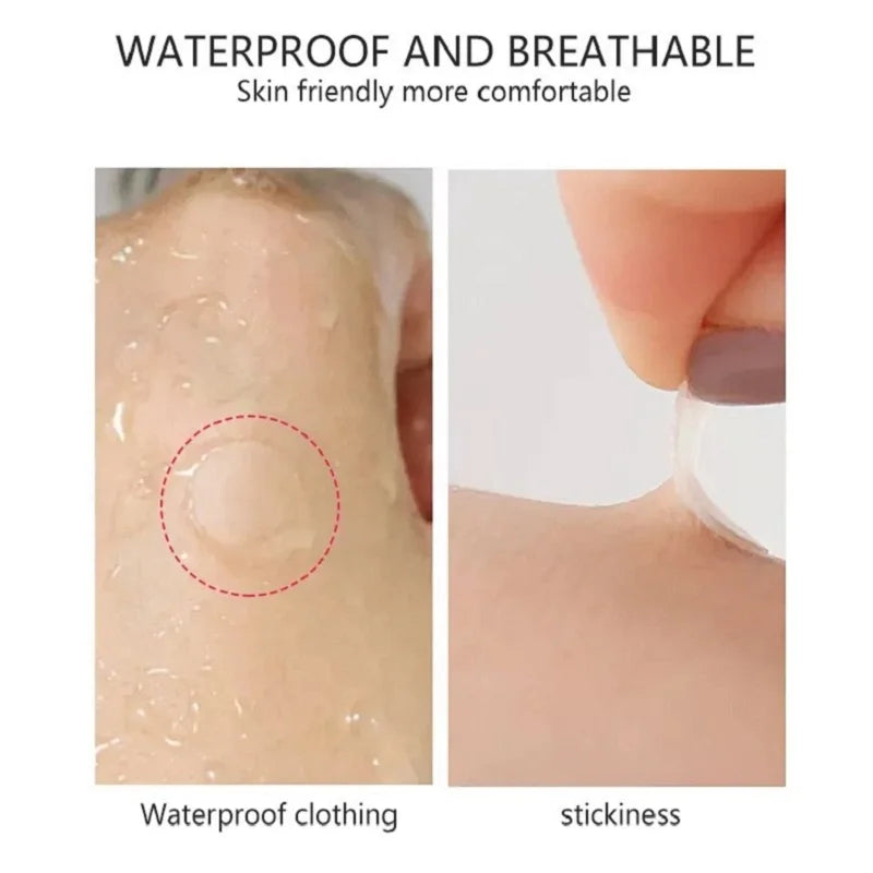 Wasserdichte hydrokolloide Akne Patches zur Hautpflege und Mitesserentfernung