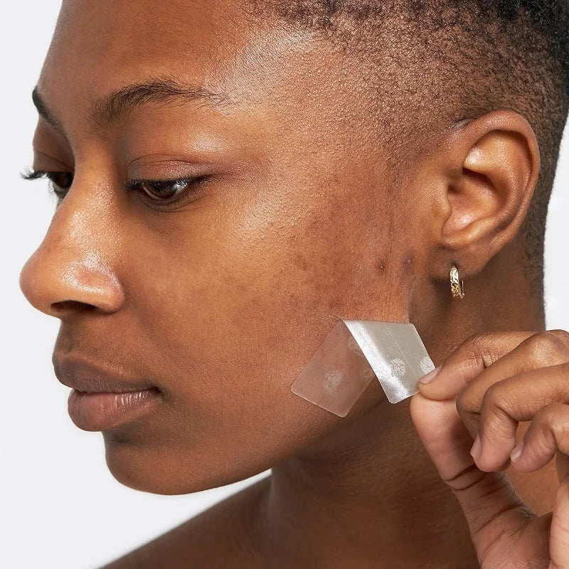 Wasserdichte hydrokolloide Akne Patches zur Hautpflege und Mitesserentfernung