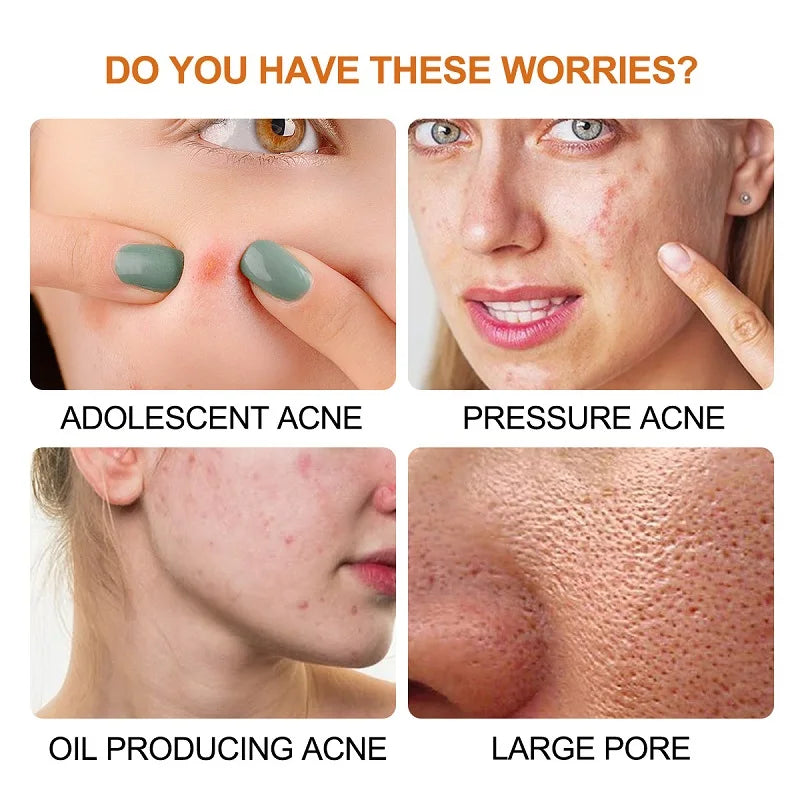 Wasserdichte hydrokolloide Akne Patches zur Hautpflege und Mitesserentfernung