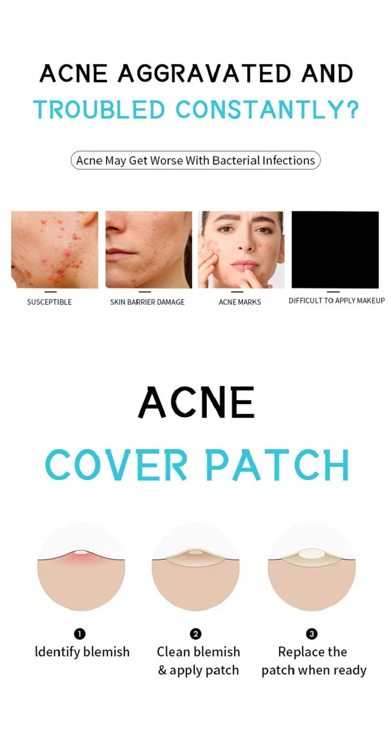 Wasserdichte hydrokolloide Akne Patches zur Hautpflege und Mitesserentfernung